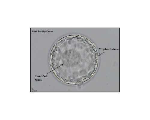 武汉代孕公司服务好,武汉公立医院试管婴儿成功率排名？武汉各医院试管成功