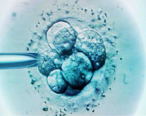 武汉中南医院*殖科哪个医*好，2025武汉中南医院试管成功率高吗