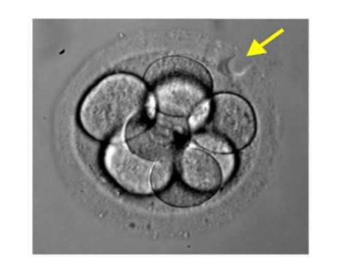 桂林市第二人民医院生殖科怎么样(淮安市第二人民医院生殖科怎么样)