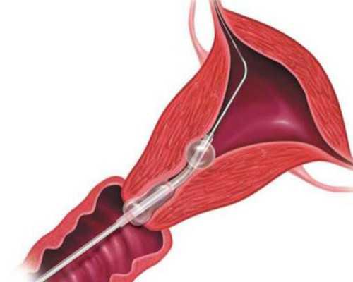 武汉有没有代孕的医院,武汉康健妇婴医院试管婴儿费用多少？武汉同济试管哪