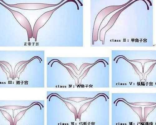 武汉代怀孕在哪,武汉做试管去哪里(武汉做试管婴儿哪里好)