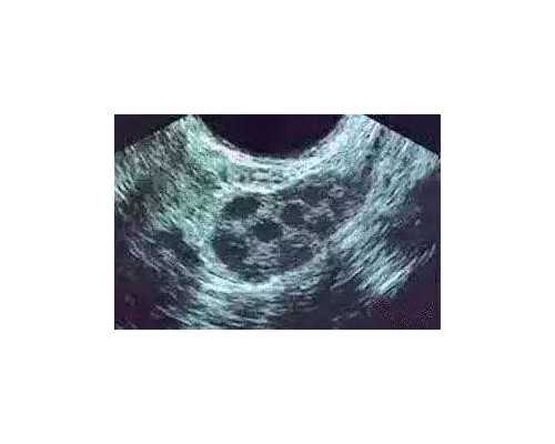 备孕期间可以做皮肤管理么