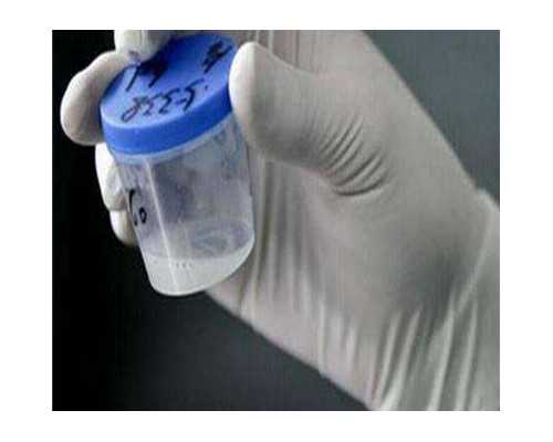 武汉供卵女孩照片,精子库的基因检测，武汉同济生殖医学专科医院