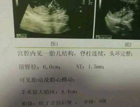 武汉市妇幼保健院：已有5000多例健康的试管宝宝在这里出生